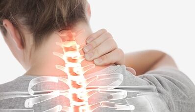 Wie man Osteochondose der Halsspalte behandelt