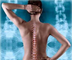 Abbildung der hinteren Wirbelsäule