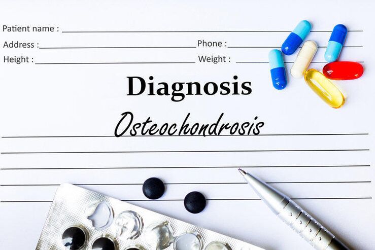 Medikamente zur Diagnose von Osteochondrose