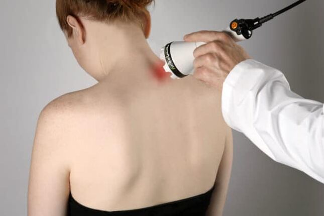 Die Lasertherapie wird zur Bekämpfung von Rückenschmerzen im Schulterblattbereich eingesetzt. 