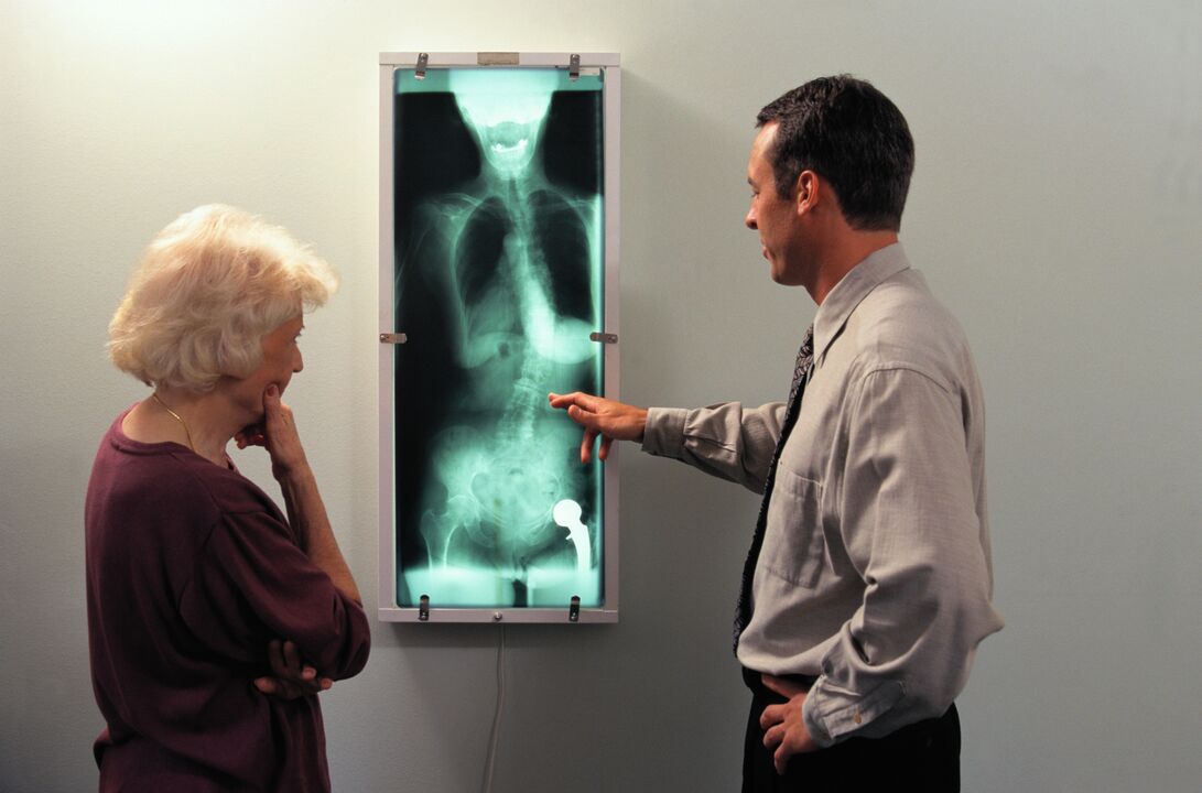 Röntgendiagnostik bei Hüftgelenksschmerzen